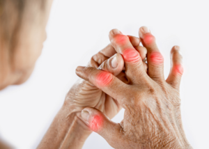 Arthritis: Causes, Symptoms & Treatments Explained | Dr Mayank Pathak